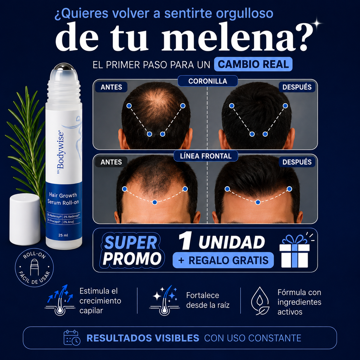 🔥 PROMOCIÓN EXCLUSIVA + REGALO GRATIS | BodyWise Hair Growth